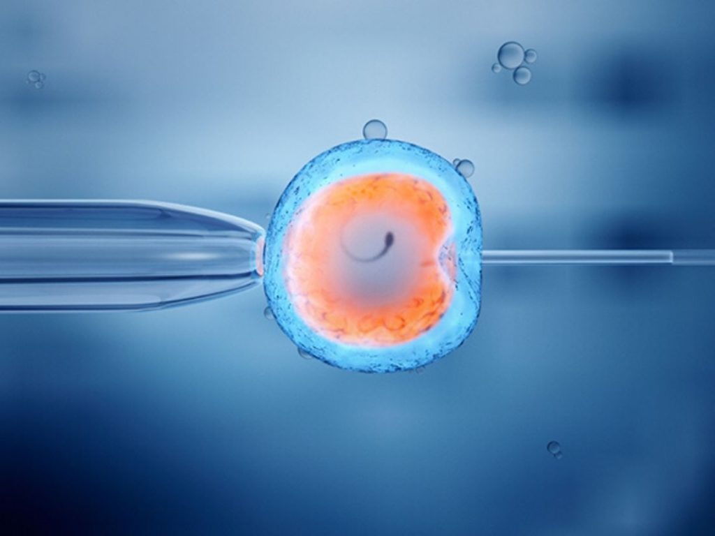 The details of IVF Treatment - Joy of Life Surrogacy