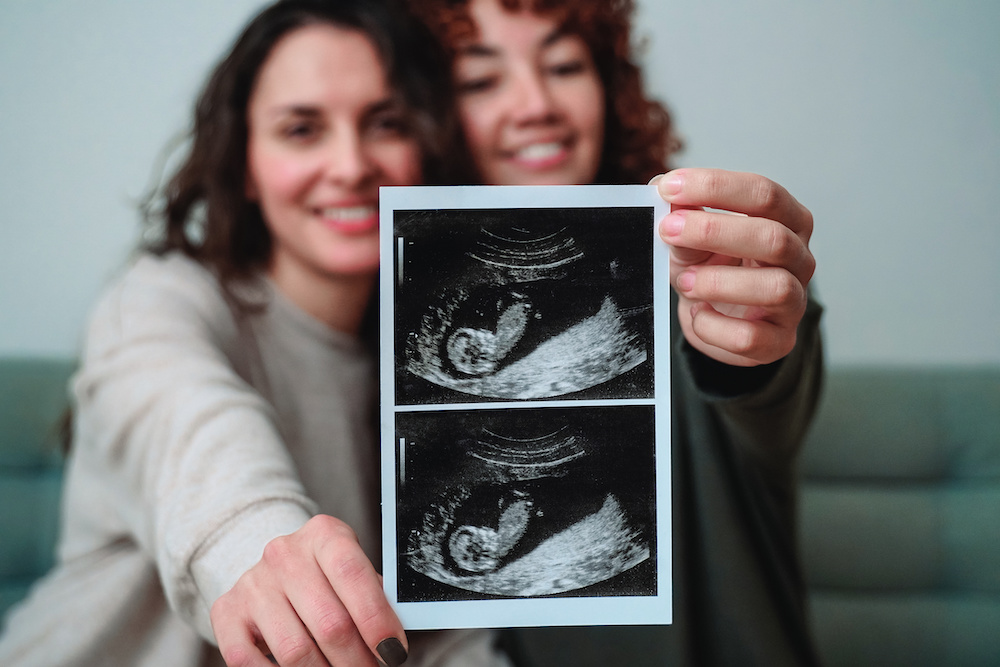 Lesbian couple showing off surrogate's ultrasound pictures